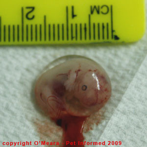 weeks fetus