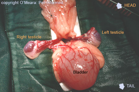 Cryptorchidism and Undescended Testicles all you need to know